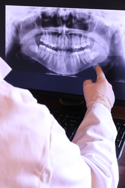 Best Emergency Wisdom Teeth Removal in Bargersville, IN