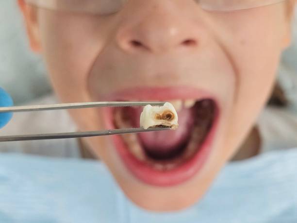 Best Emergency Treatment for Toothache in Bargersville, IN